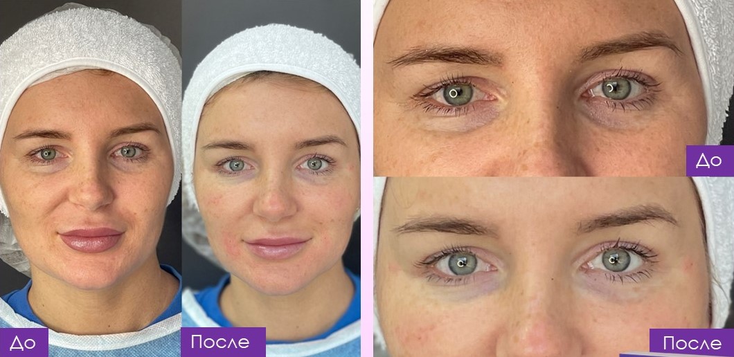 Результат 1