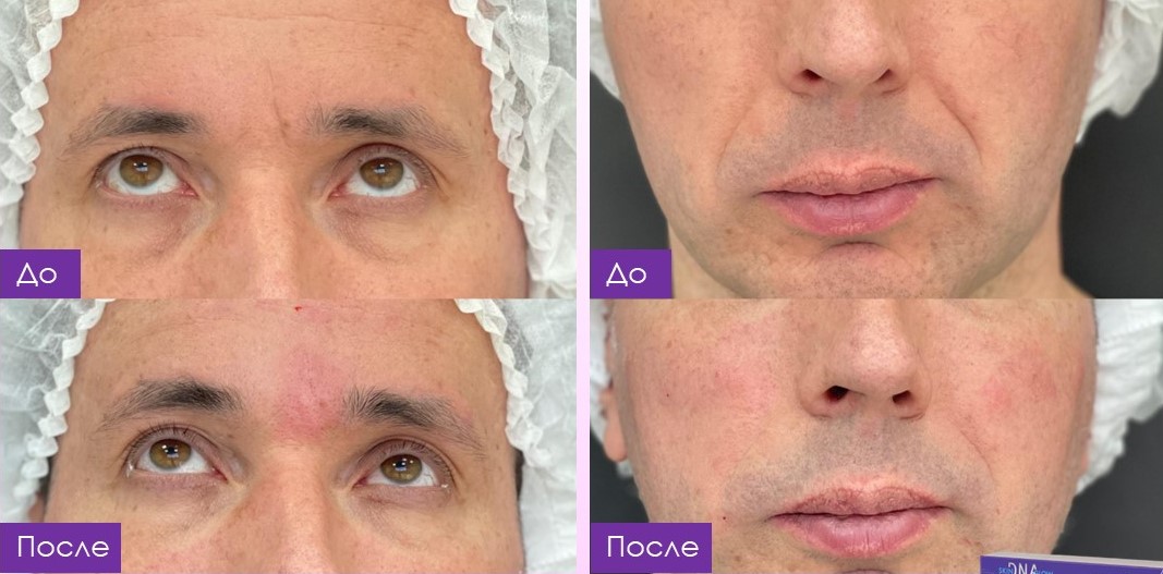 Результат 2