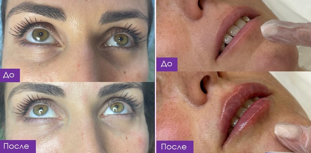 Результат 3